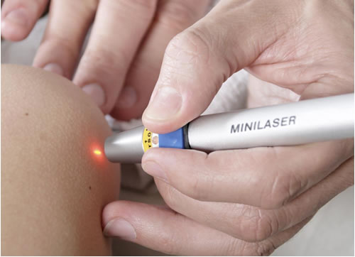 Laser Beam Therapy