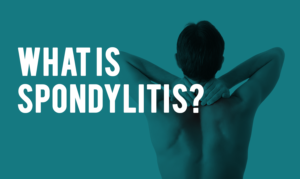 what-is-spondylitis