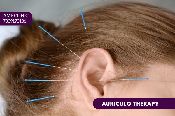 Acupuncture Auriculo Therapy