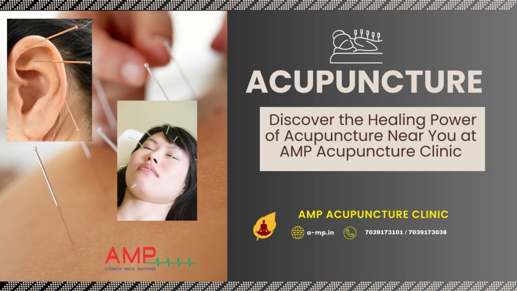 acupuncture near me