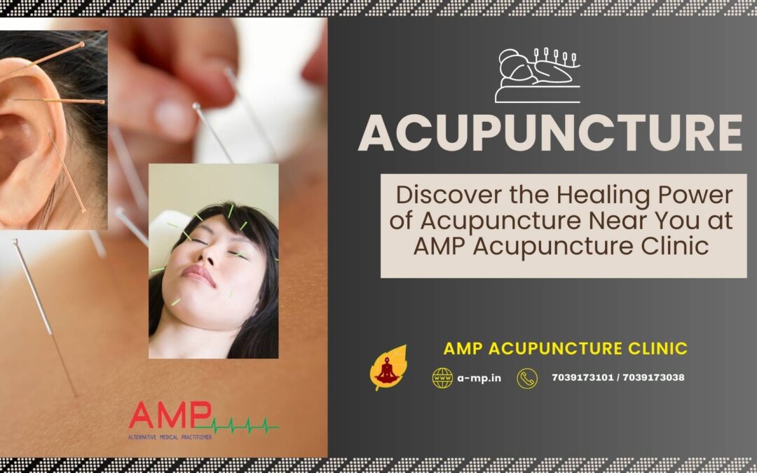 Acupuncture Near You at Vashi Navi Mumbai