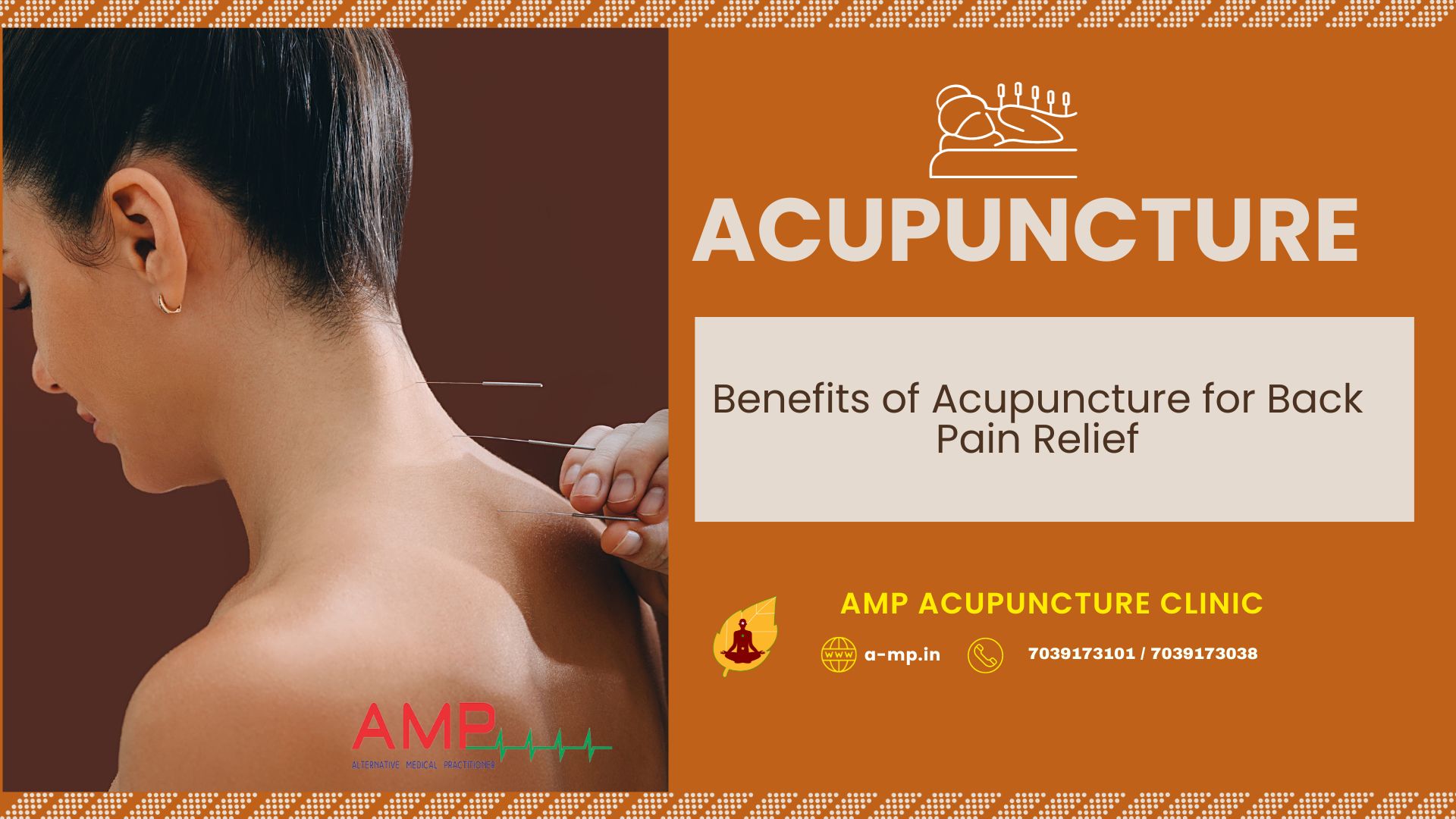 acupuncture-for-back-pain-relief