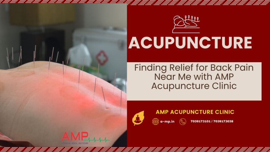 acupuncture for back pain near me