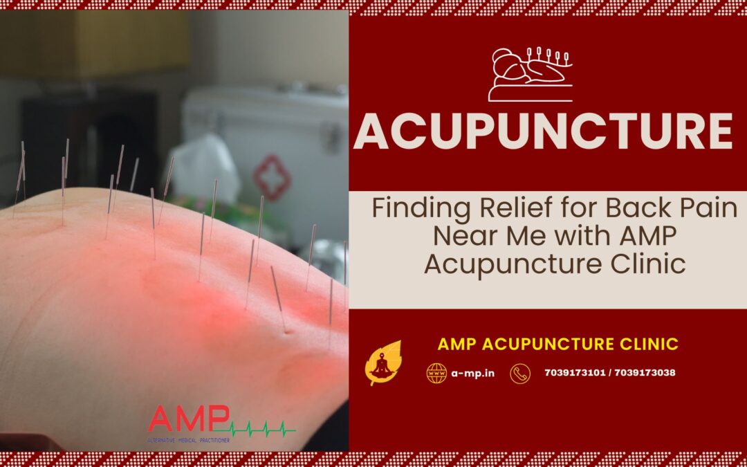 Acupuncture for Back Pain Near Me