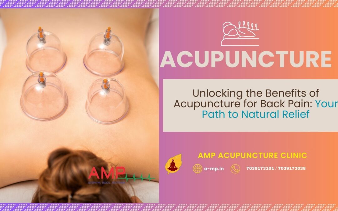 Benefits of acupuncture for back pain