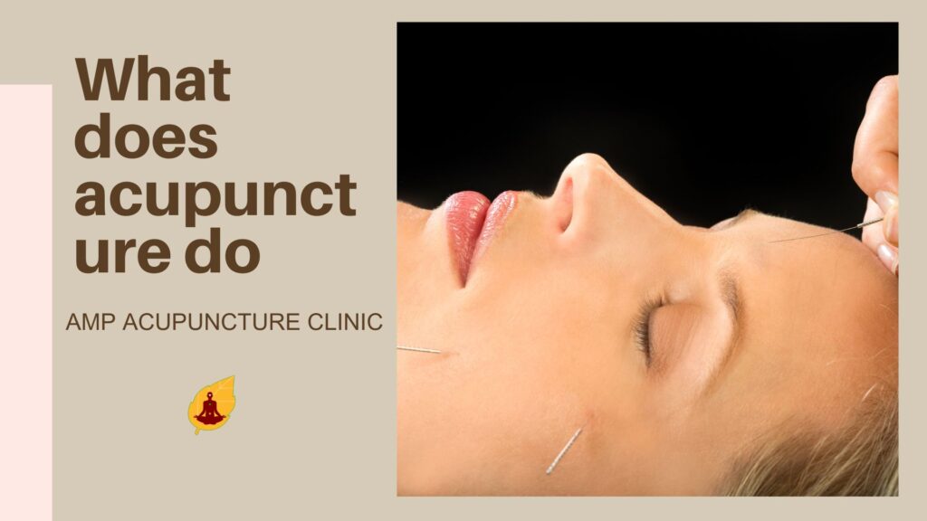 what does acupuncture do