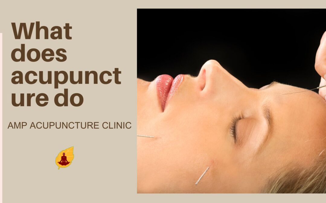 What does acupuncture do?
