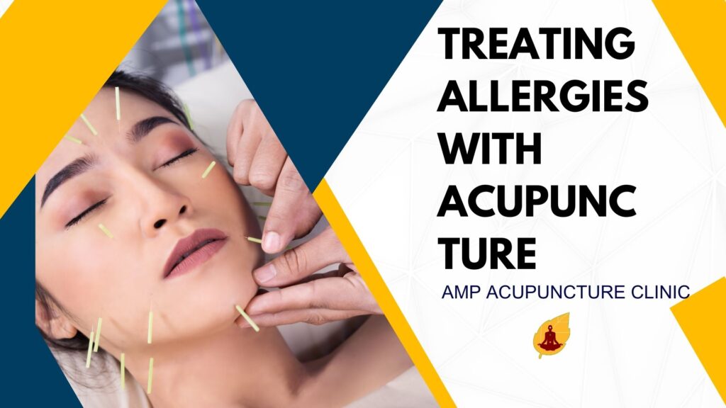 Treating Allergies with Acupuncture