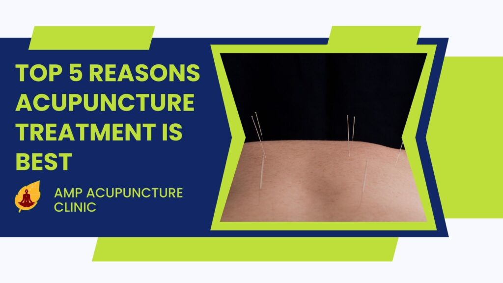 Top 5 Reasons Acupuncture Treatment Is Best