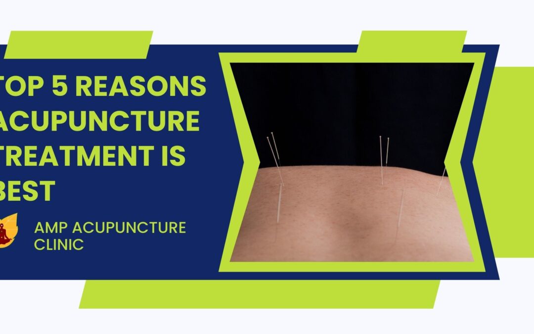 Top 5 Reasons Acupuncture Treatment Is Best