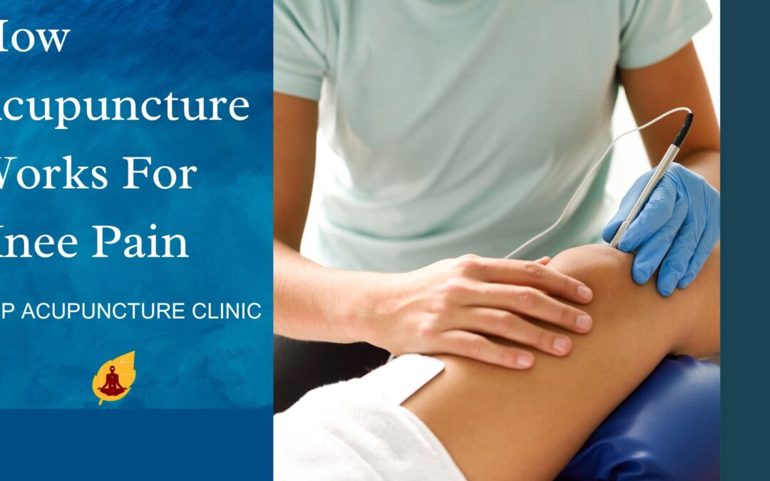 How Acupuncture Works For Knee Pain