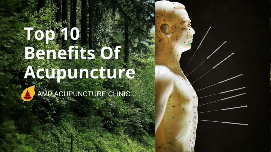 Top 10 benefits of acupuncture