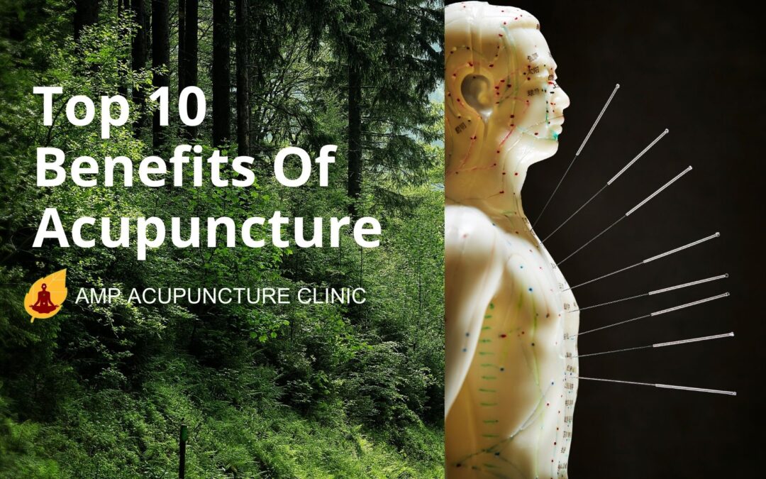 Top 10 Benefits Of Acupuncture