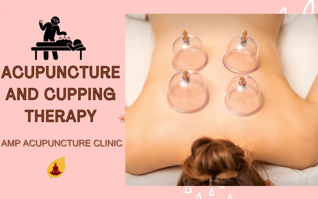 How Does Acupuncture & Cupping Work