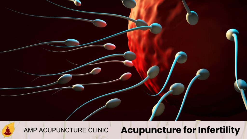 Acupuncture for Infertility