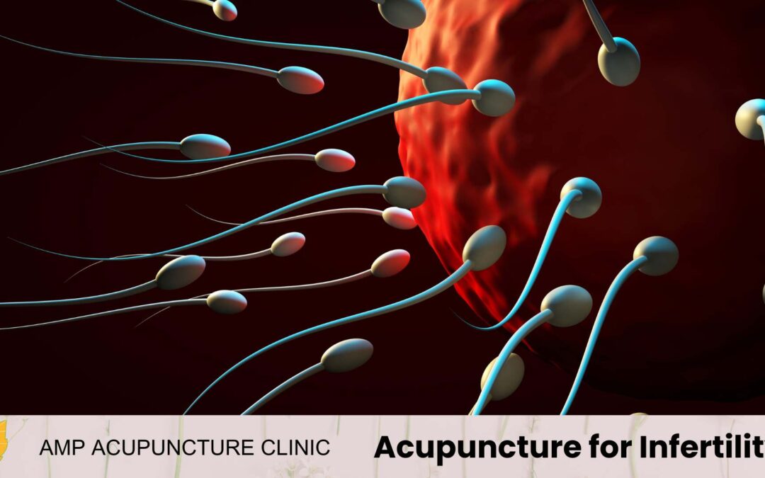 Acupuncture for Infertility