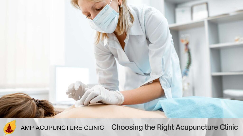 Choosing the Right Acupuncture Clinic