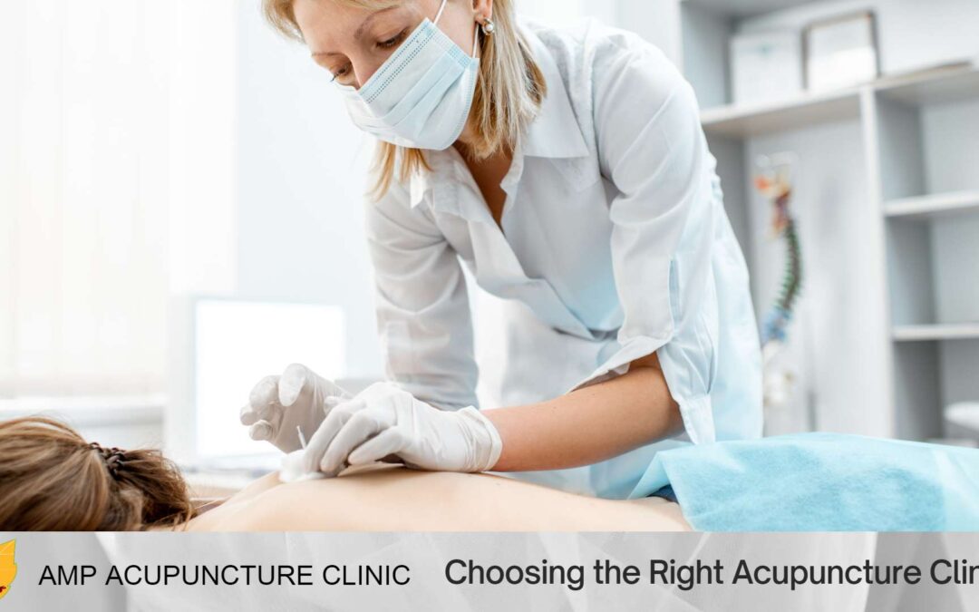 Choosing the Right Acupuncture Clinic