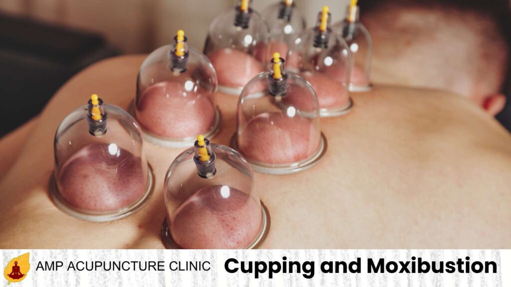 Cupping and Moxibustion