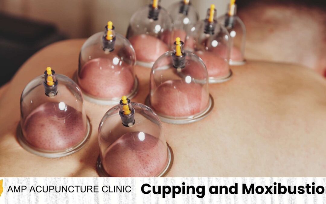 Cupping And Moxibustion