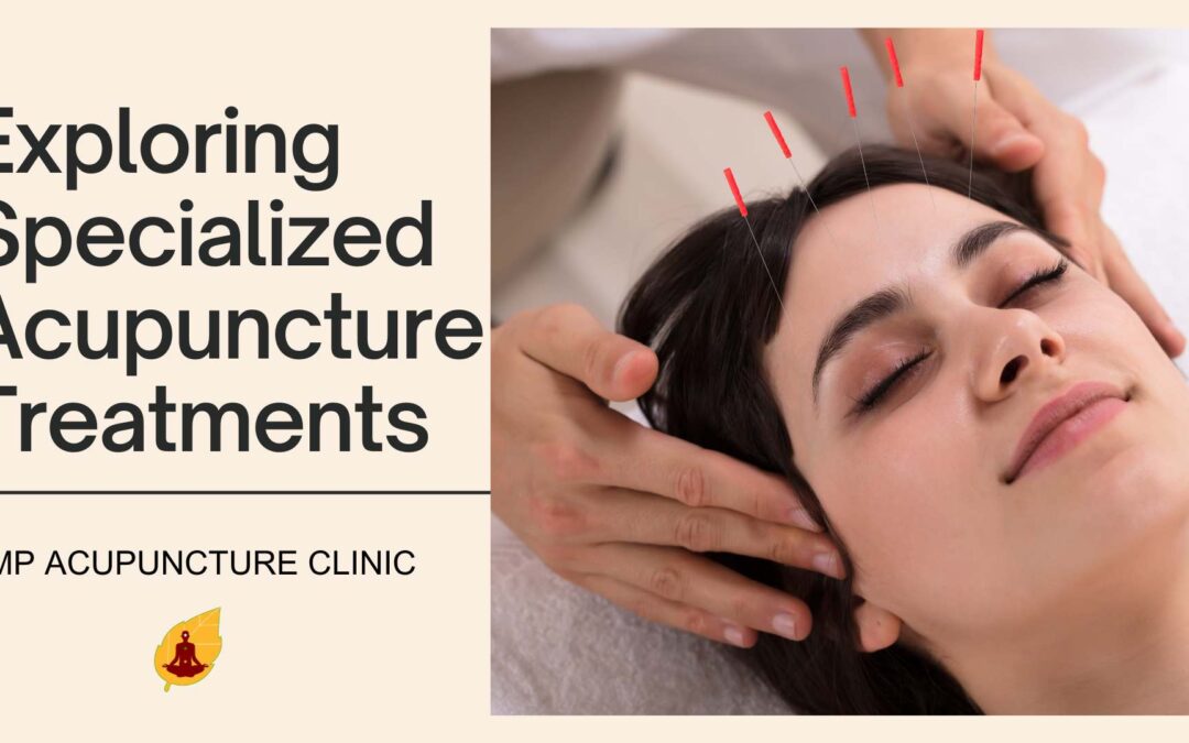 Exploring Specialized Acupuncture Treatments : Top 4 Benifits