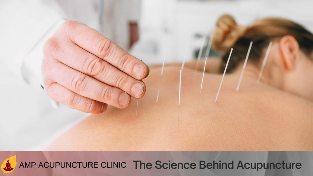 The Science Behind Acupuncture