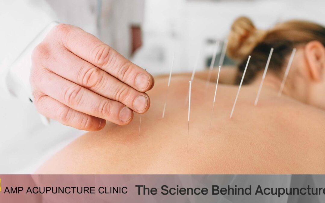 The Science Behind Acupuncture