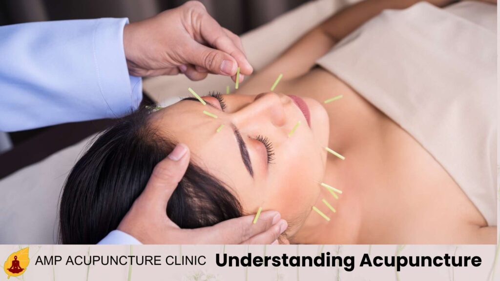 Understanding Acupuncture