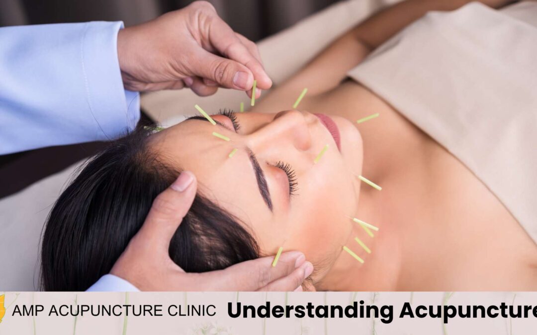 Understanding Acupuncture