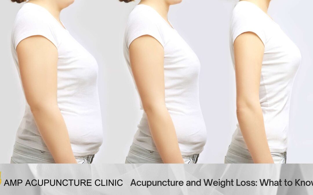 Acupuncture and Weight Loss: What to Know