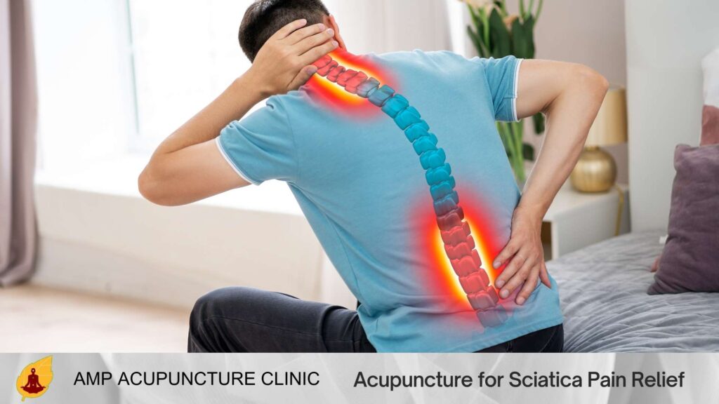 Acupuncture for Sciatica Pain Relief