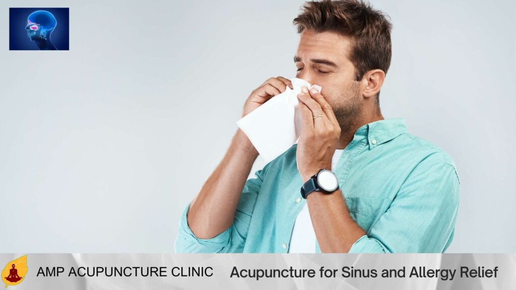 Acupuncture for Sinus and Allergy Relief