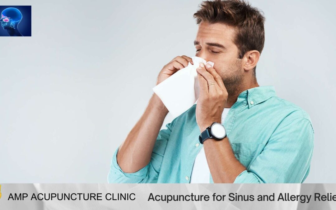 Acupuncture for Sinus and Allergy Relief