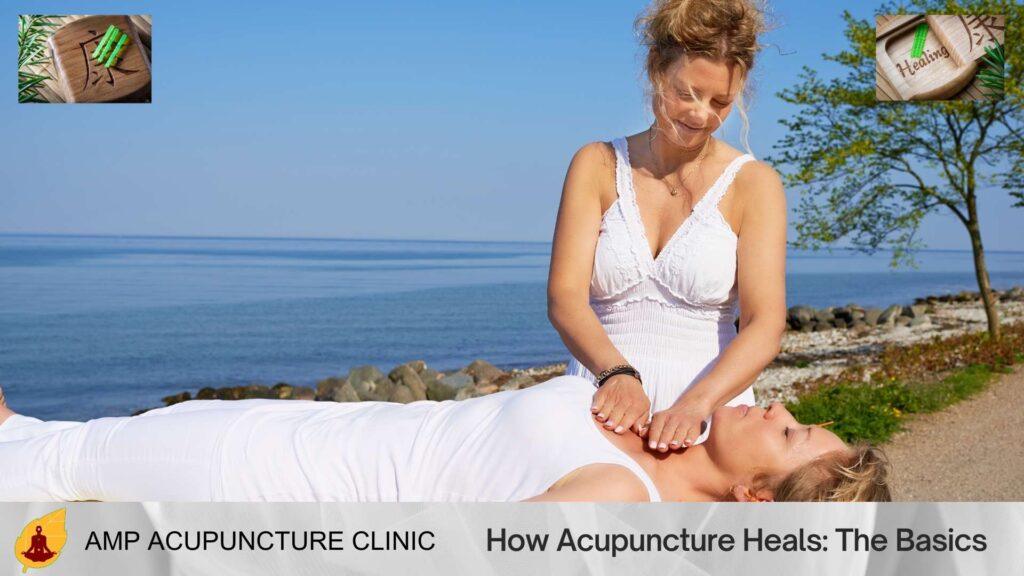 How Acupuncture Heals: The Basics