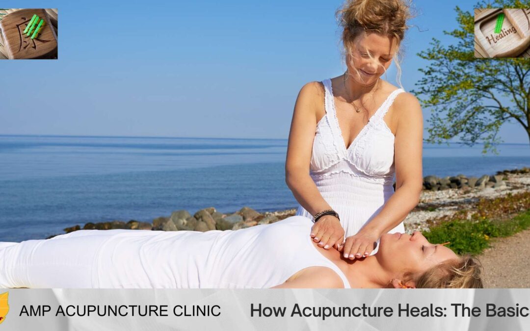 How Acupuncture Heals: The Basics