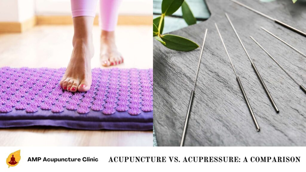 Acupuncture vs. Acupressure: A Comparison