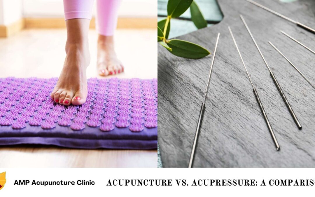 Acupuncture vs. Acupressure: A Comparison