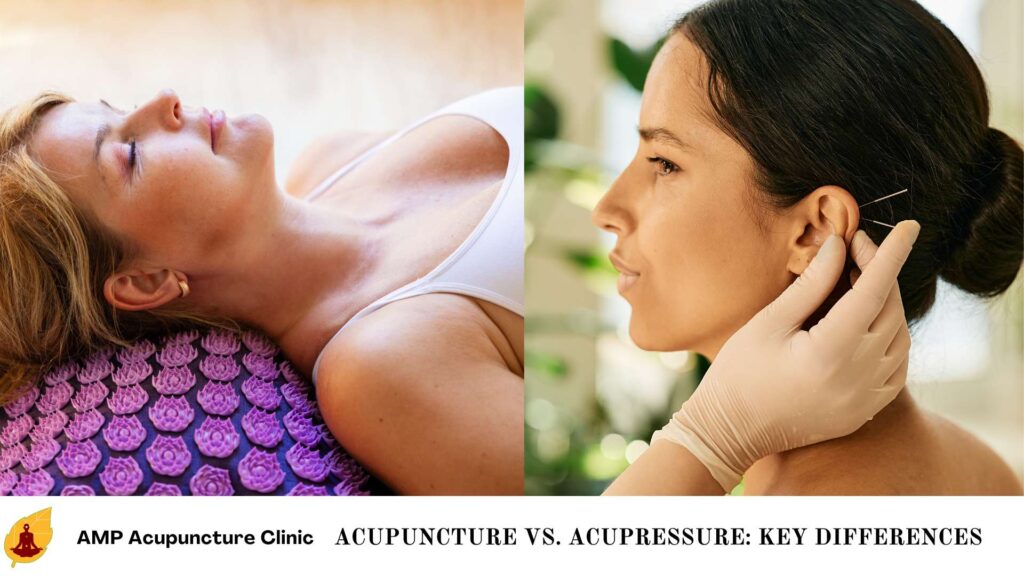 Acupuncture vs. Acupressure: Key Differences