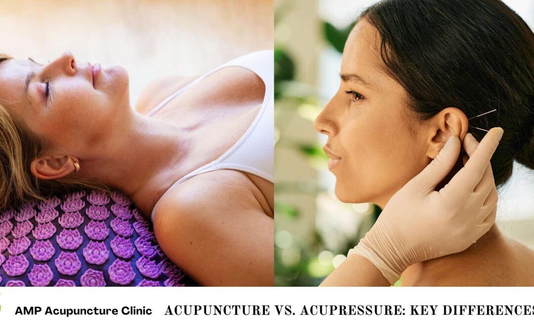 Acupuncture vs. Acupressure: Key Differences