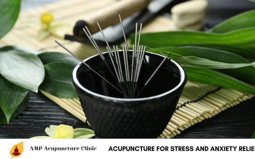 Acupuncture for Stress and Anxiety Relief