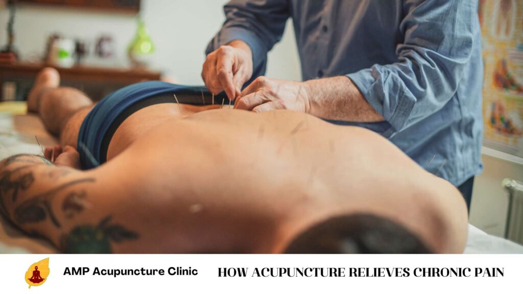 How Acupuncture Relieves Chronic Pain