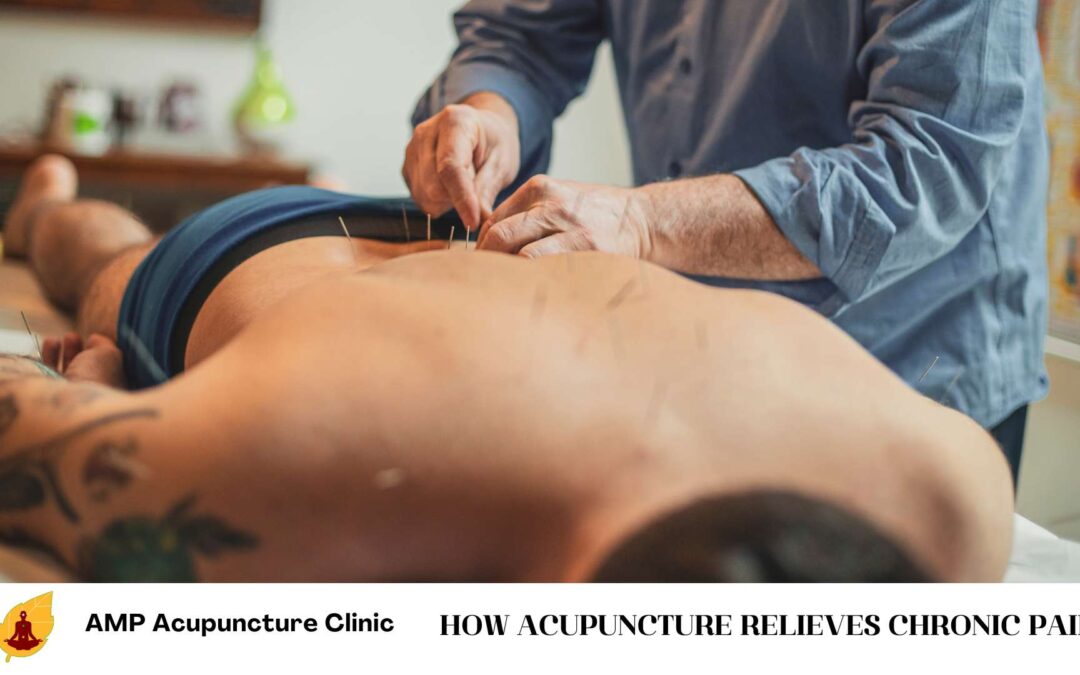 How Acupuncture Relieves Chronic Pain