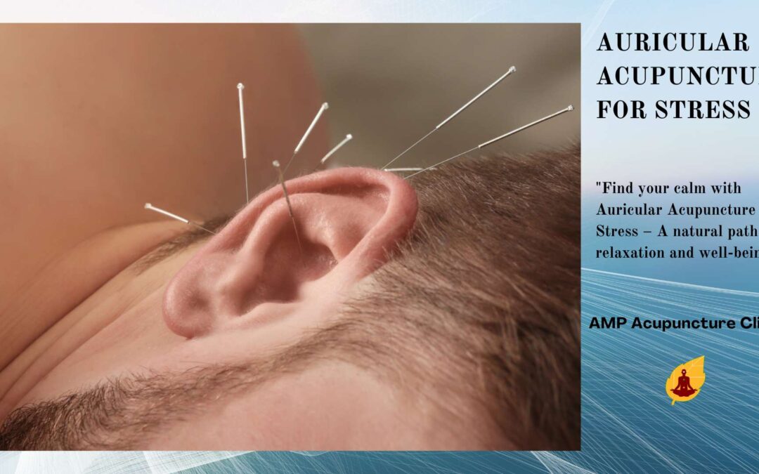 auricular acupuncture for stress